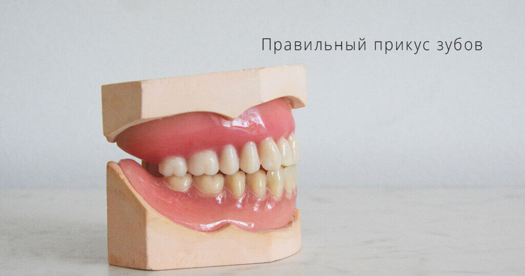 Как неправильное смыкание зубов разрушает пломбы